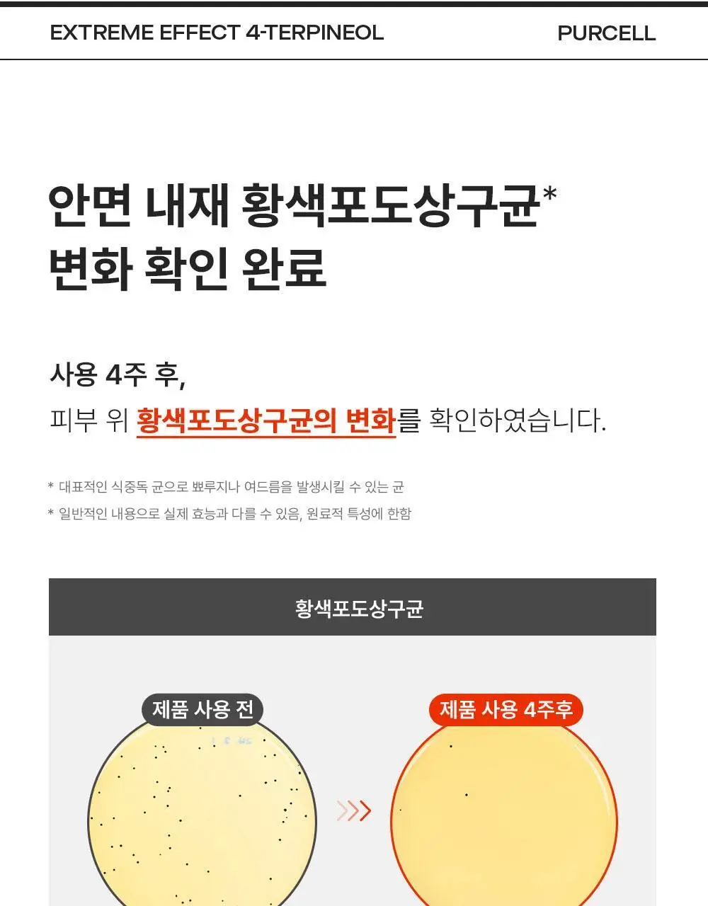 [트러블케어/스팟진정] 퍼셀 익스트림 이펙트 터피네올 원액 10ml 상세페이지 12